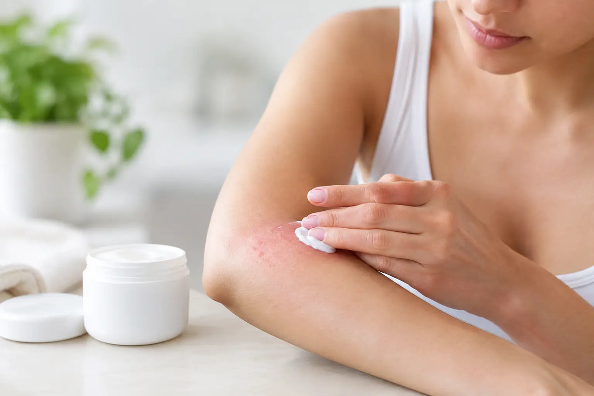 Crema para dermatitis y piel con comezón