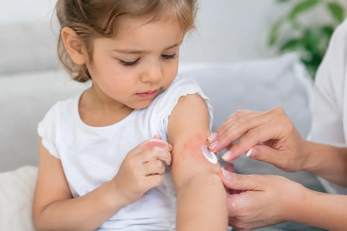 Cuidado piel infantil: dermatitis sin irritar más
