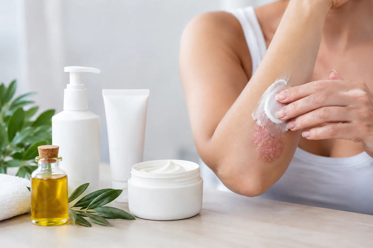 Guía de emolientes para psoriasis y placas