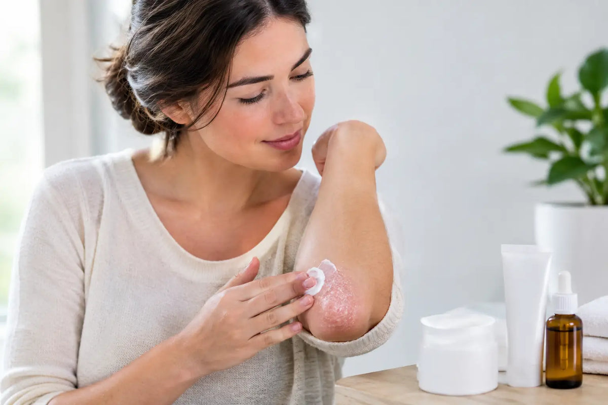 Tratamiento para psoriasis sin descuidar tu piel
