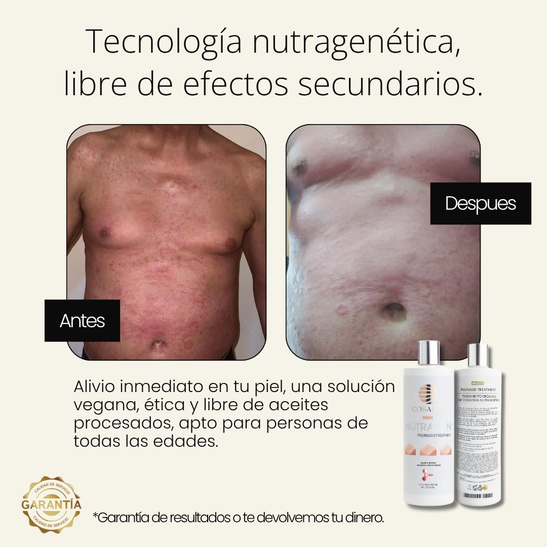 Antes y después torso