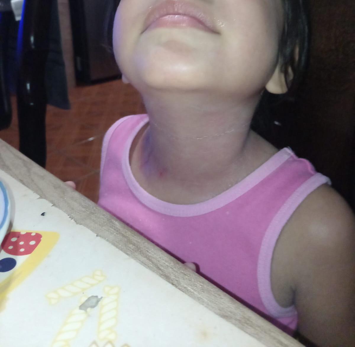 Caso cuello
