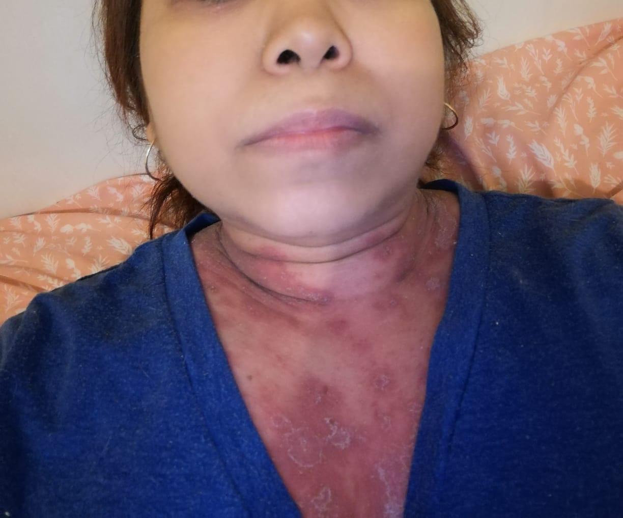 Cuello antes