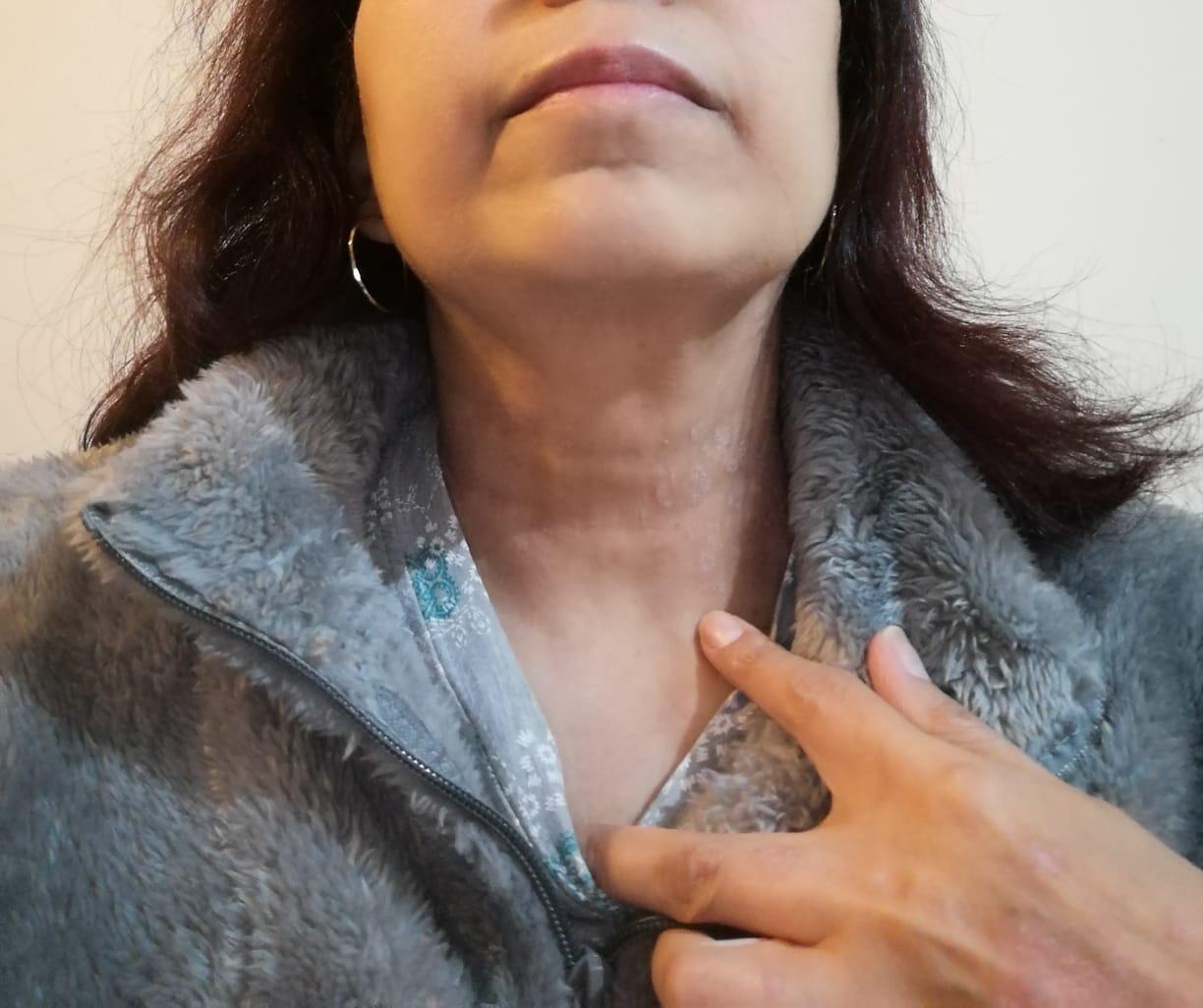 Cuello después