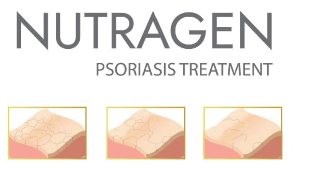 Fases de recuperación de la piel con Nutragen