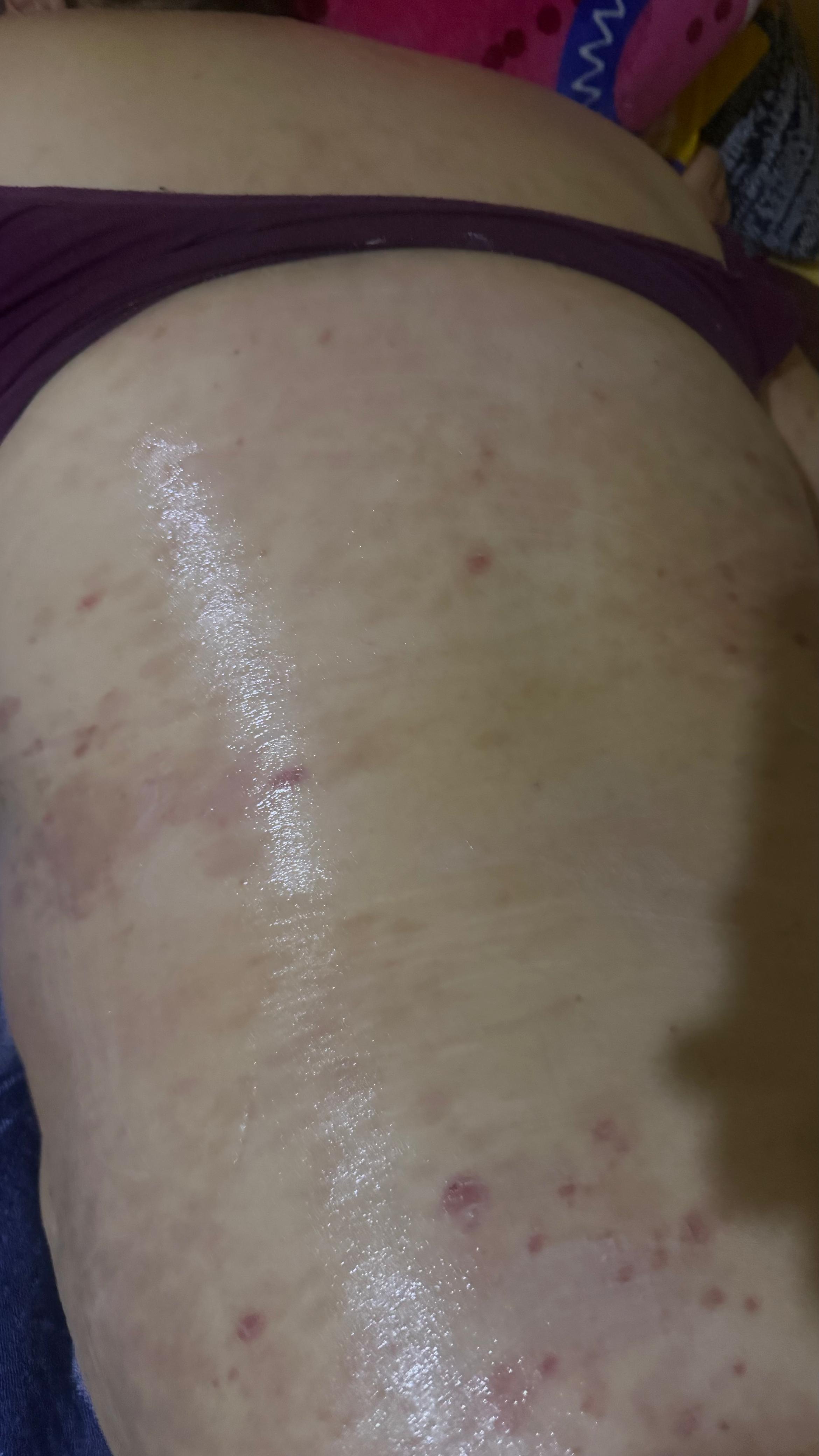 MUSLO · PIEL RECUPERADA