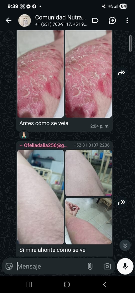 Piernas antes y después