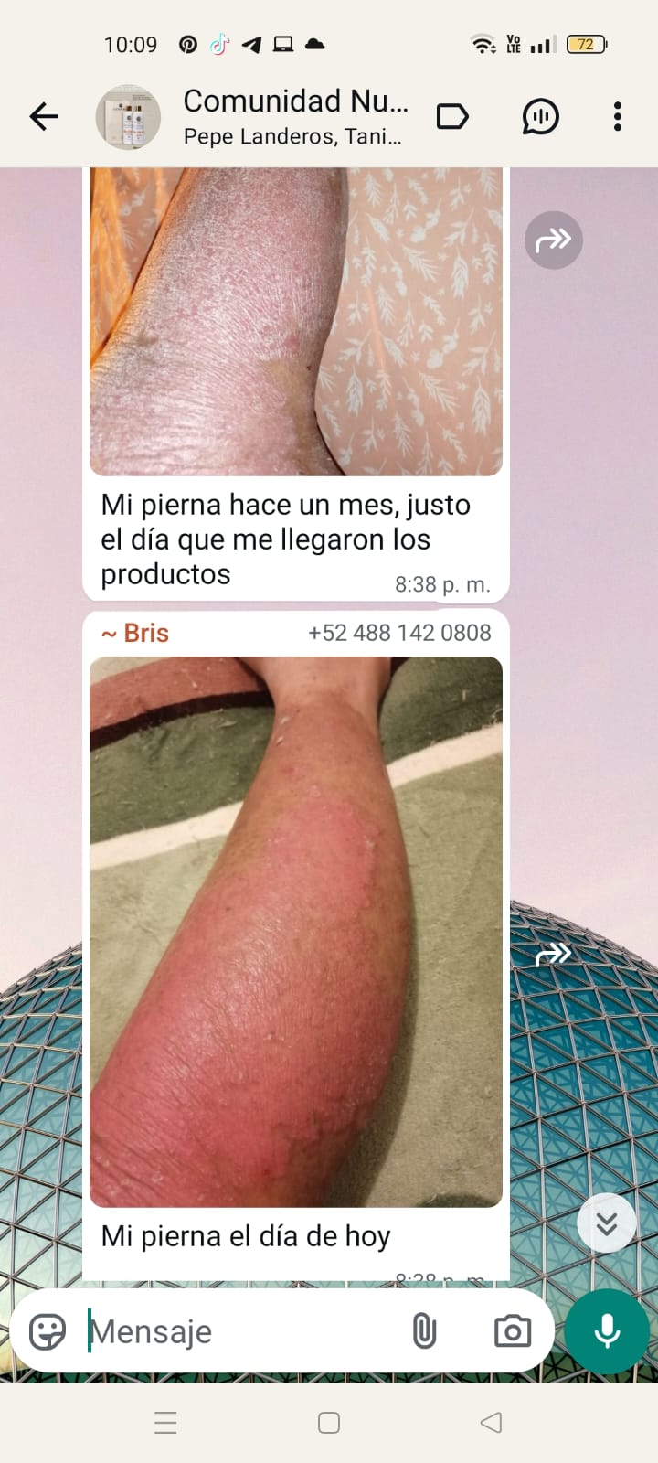 PIERNA · MES 1 VS. HOY