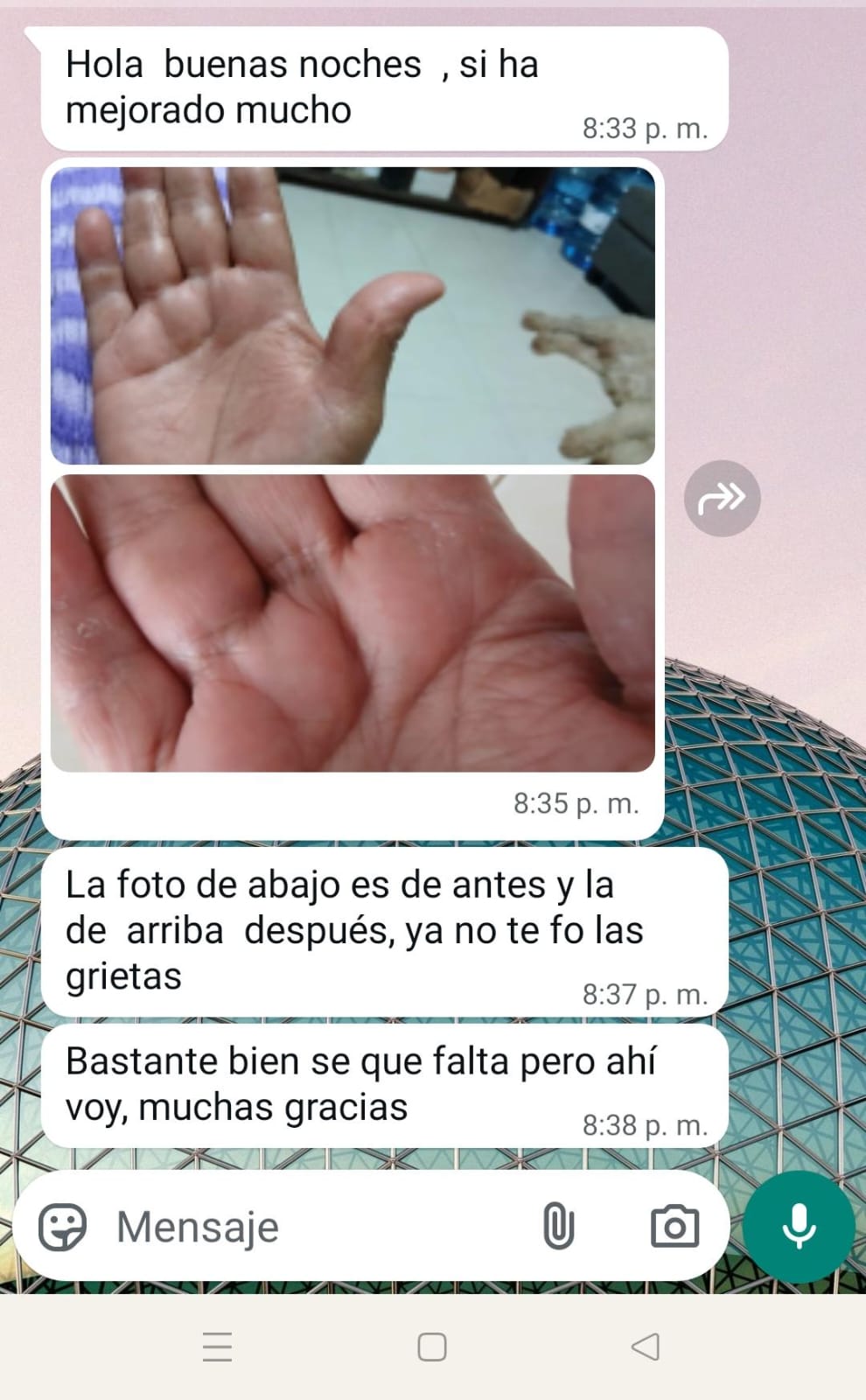 Manos antes y después
