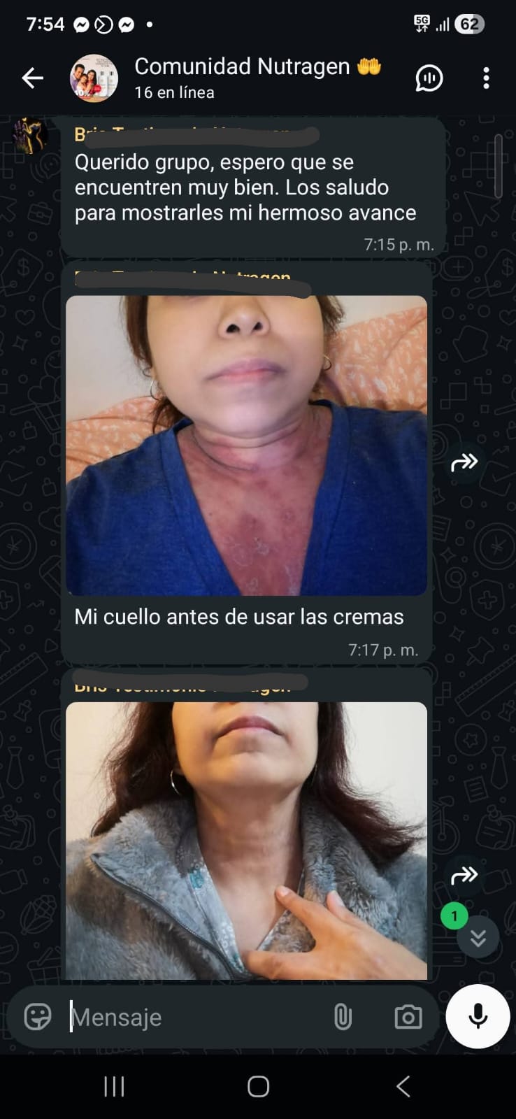 CUELLO · ANTES Y DESPUÉS