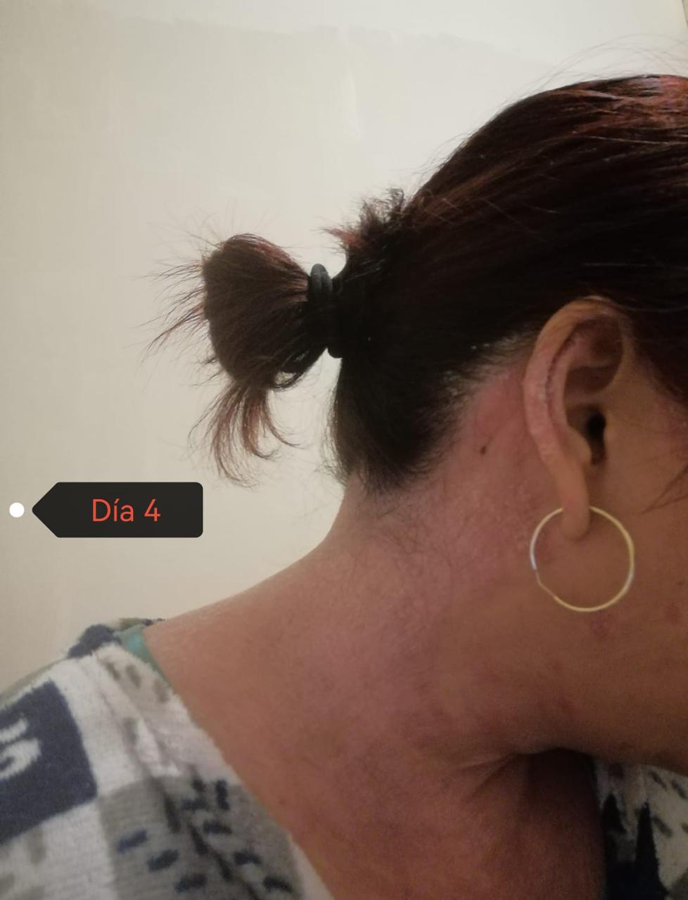Nuca día 4