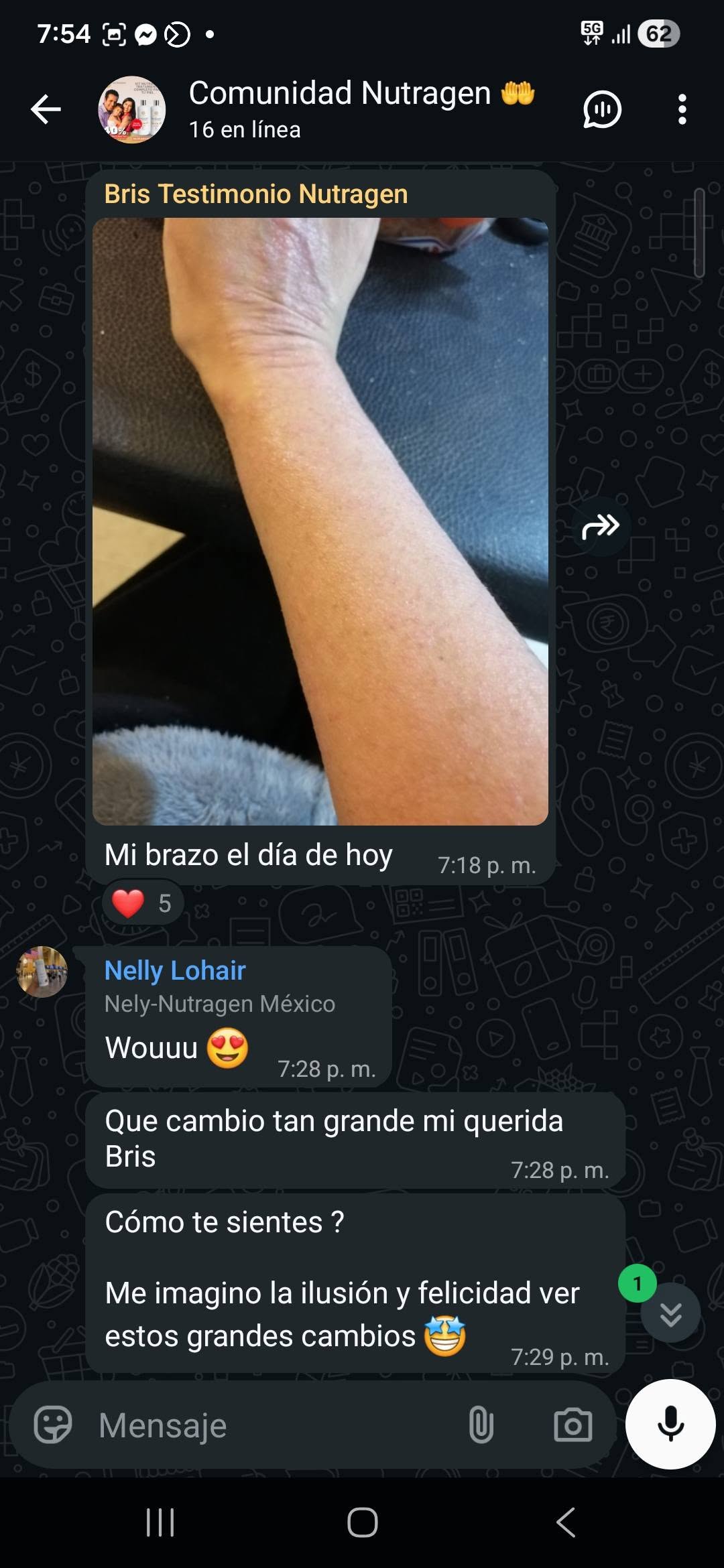 &ldquo;Mi brazo el día de hoy&rdquo; — Bris