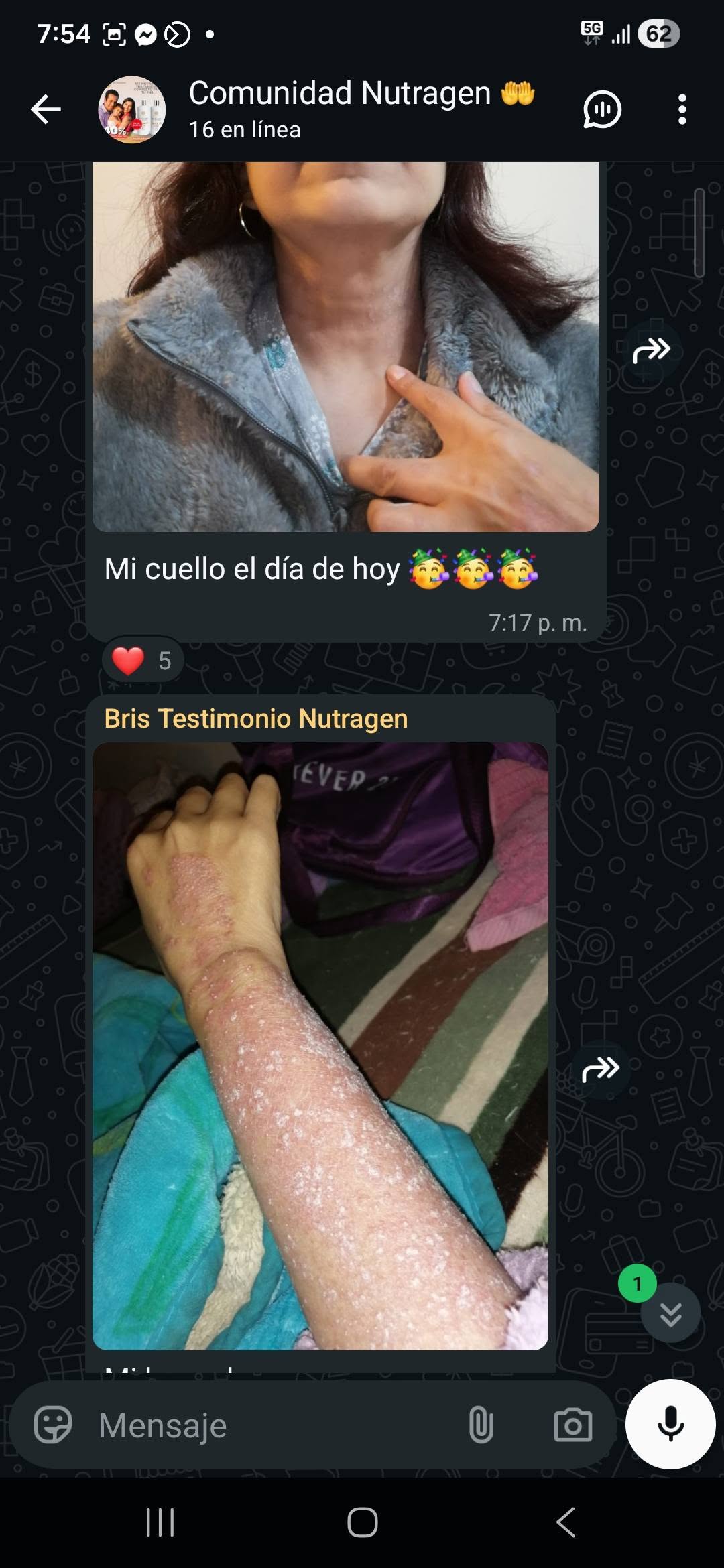&ldquo;Mi cuello el día de hoy 🥳&rdquo;