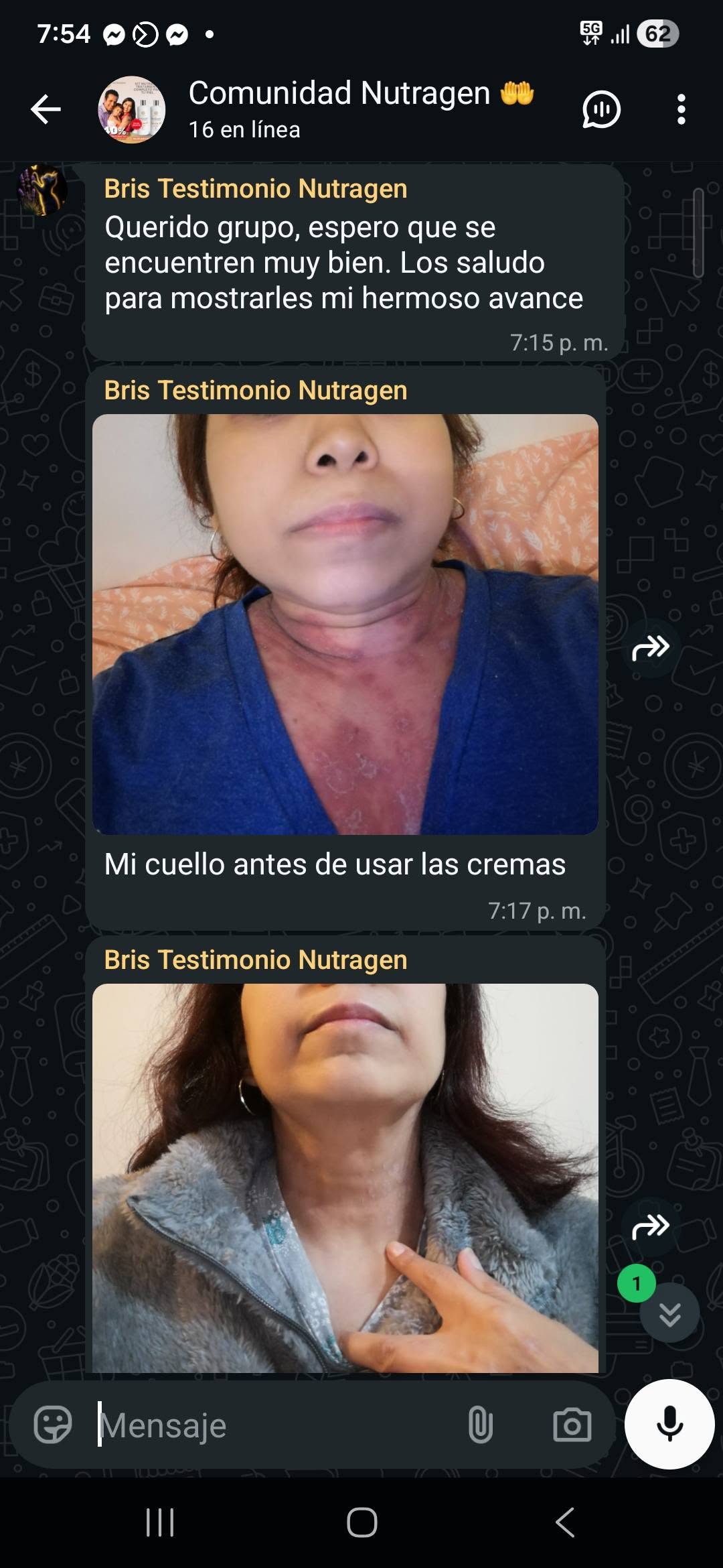 &ldquo;Mi cuello antes de usar las cremas&rdquo; → y hoy